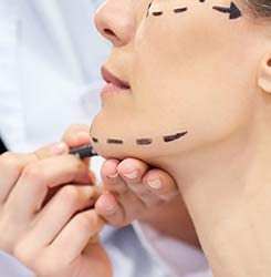 Thread lift & Dermal Fillers
