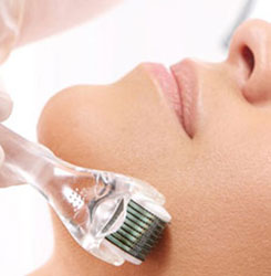 Dermaroller /Dermapen