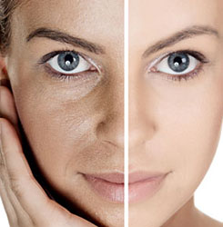 PRP Therapy