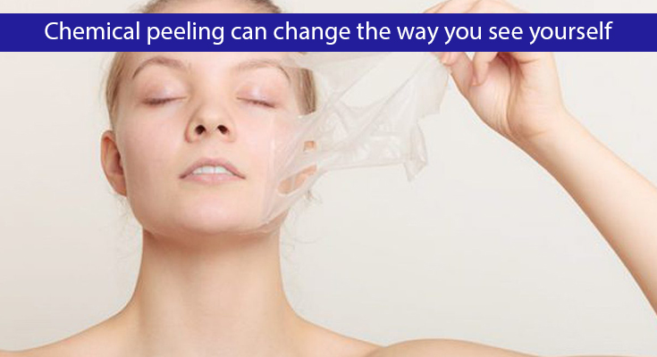 Chemical peeling can change the way you see yourself.