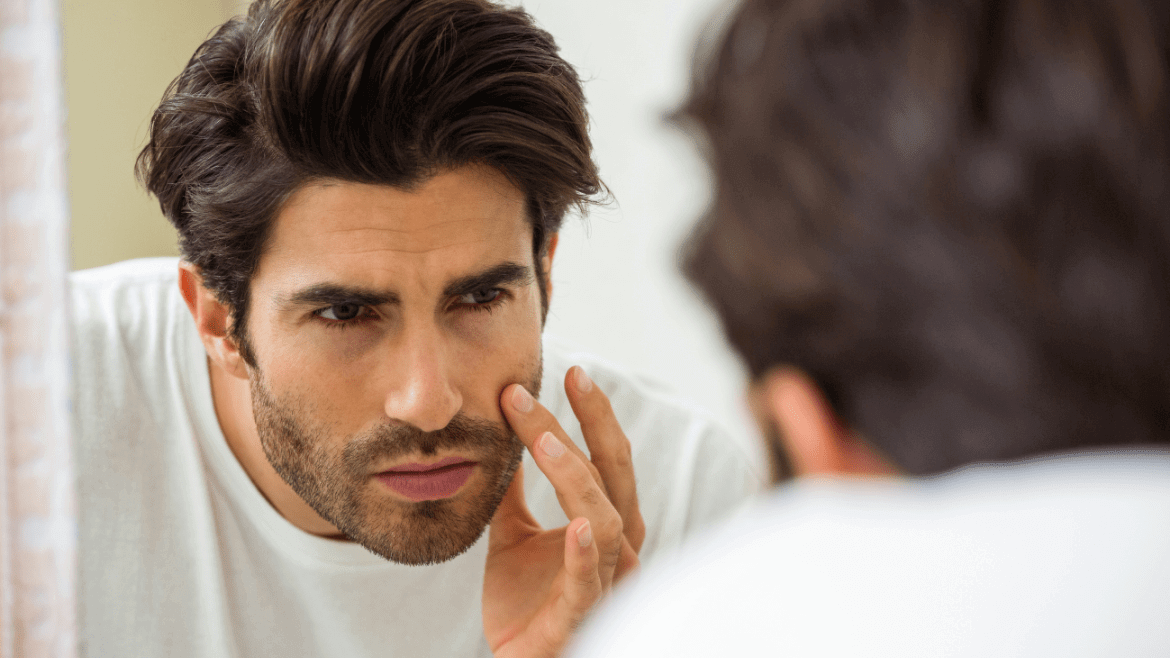 Questions Every Man Wants to Ask a Dermatologist!
