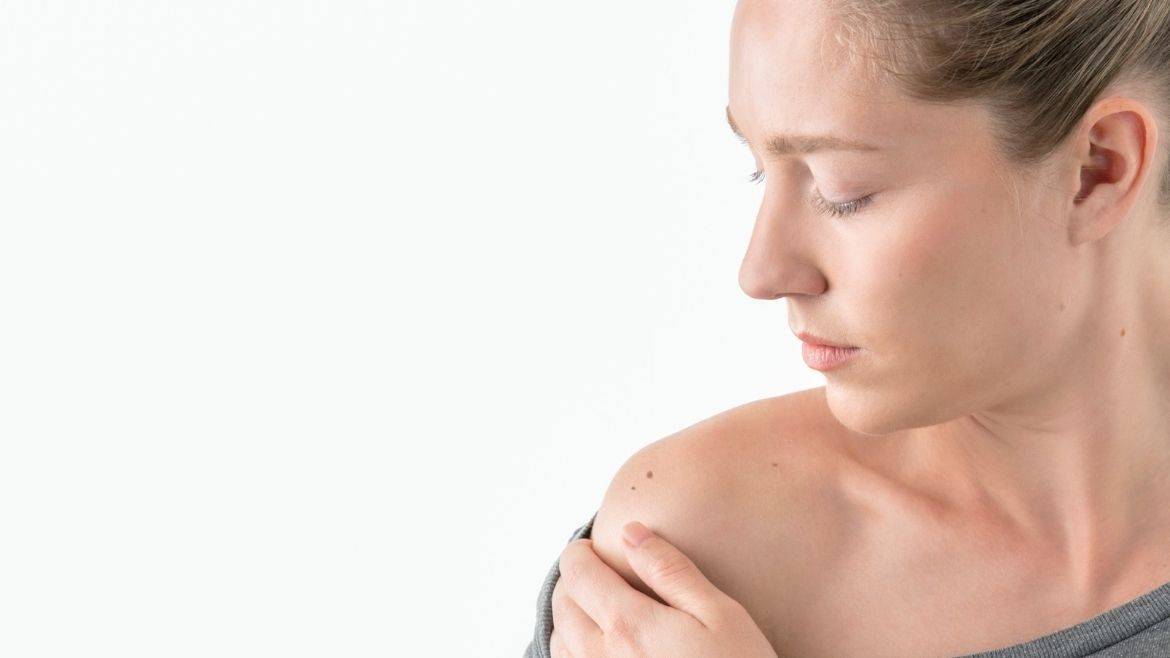 Skin Cancer: Initial Symptoms, Characteristics, and Treatment