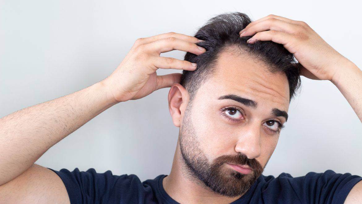 Common Hair Transplant Mistakes to Avoid