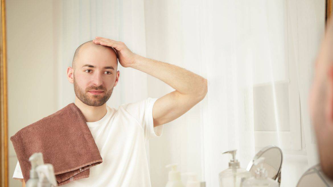 How to Decide if a Hair Transplant is Right for you