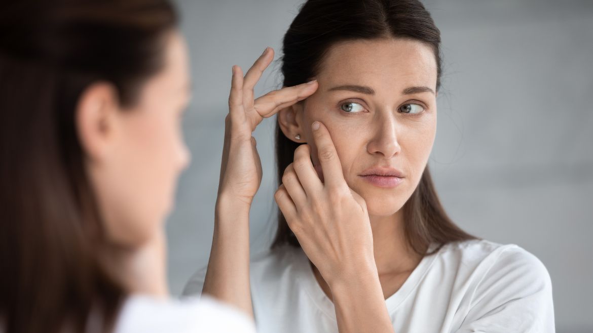 5 Simple Ways to Prevent Acne Breakouts