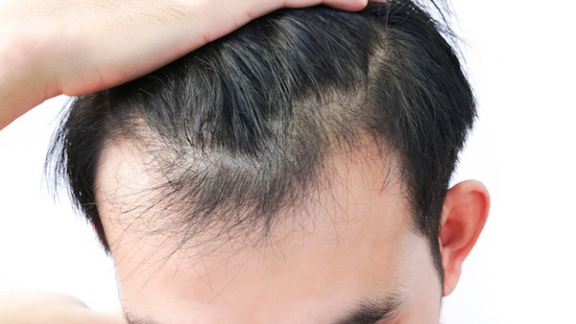 Revitalizing Tresses: Exploring How PRP Treatment Enhances Hair Growth and Minimizes Hair Loss