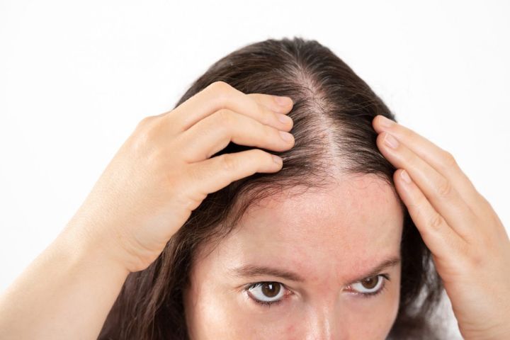 Hair Transplant in Women: Breaking the Stigma