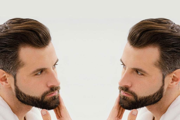 Hair Transplant for Beard and Eyebrows: What You Need to Know