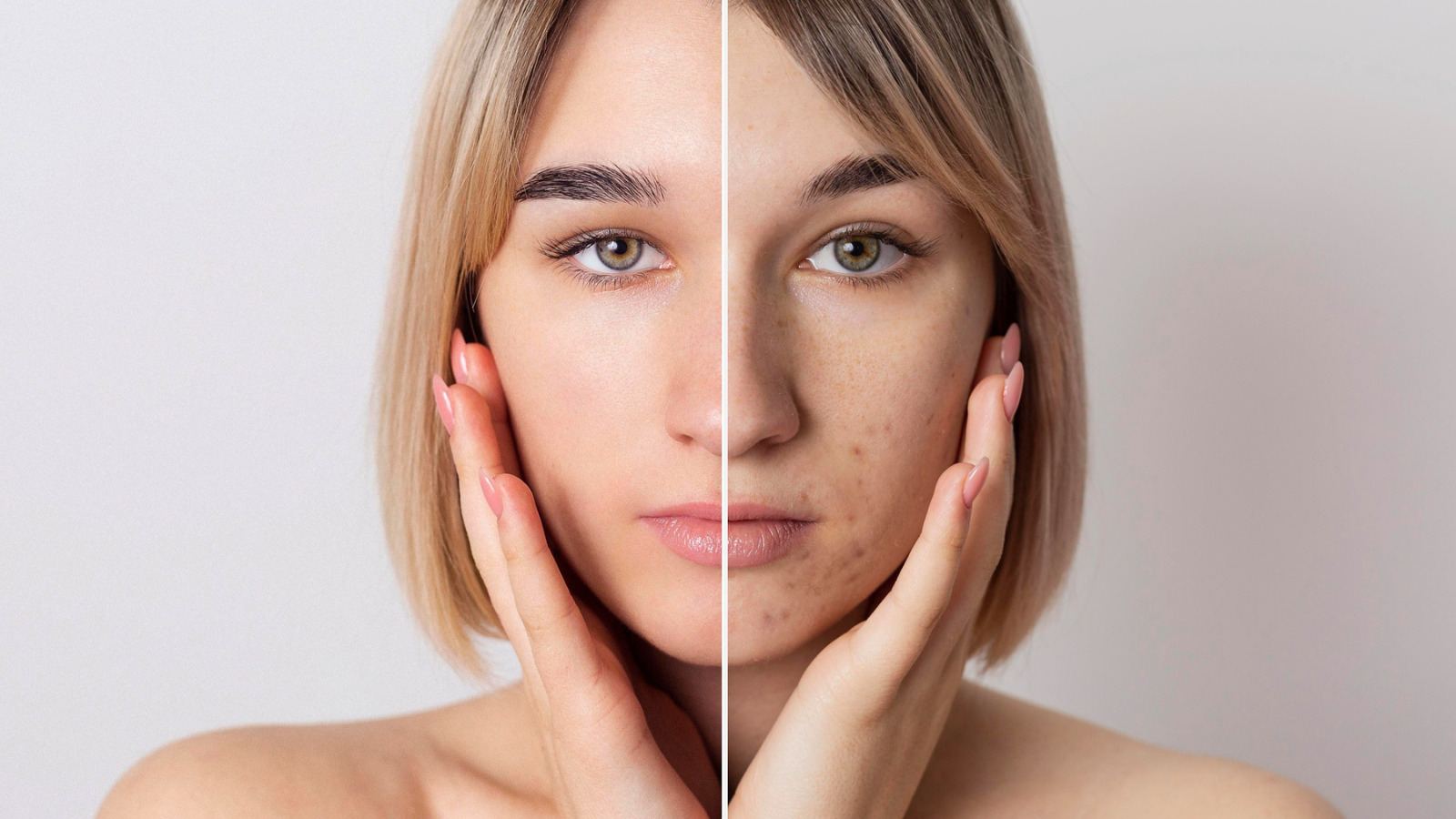 Skin Changes During Perimenopause and How to Treat Them