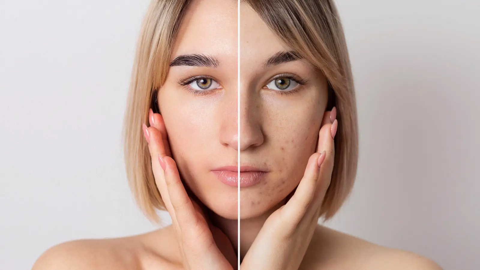 Skin Changes During Perimenopause and How to Treat Them